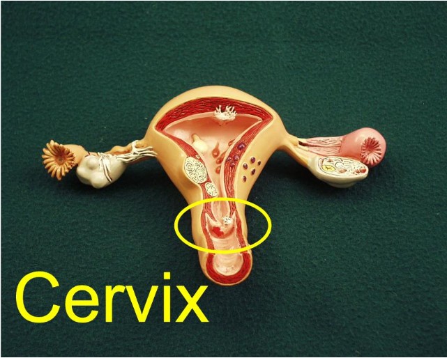 arnold morfe add pound her cervix photo