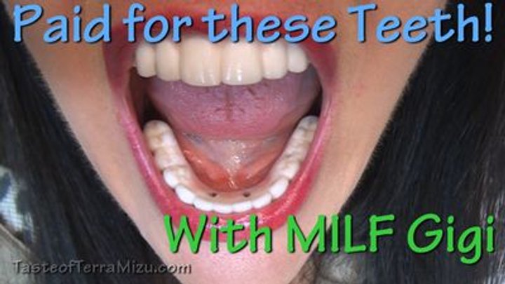 amadou dia recommends milf teeth pic