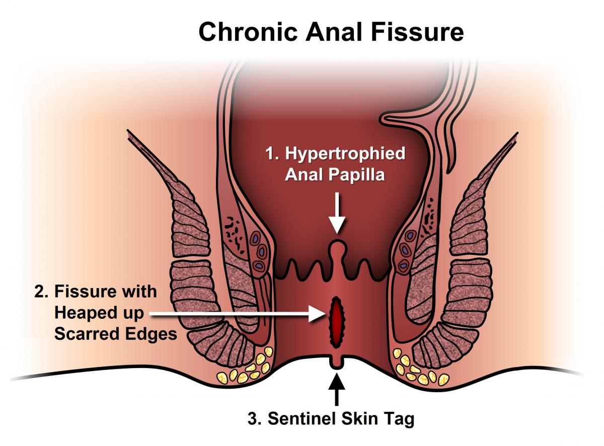 ashraf toson recommends anal category pic