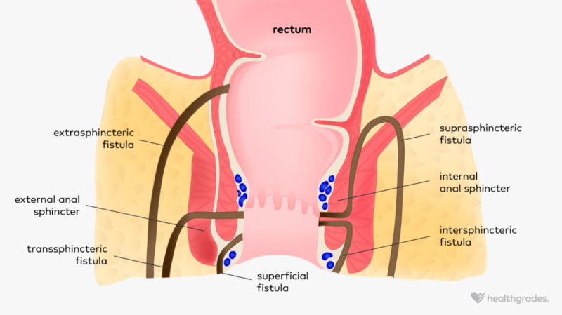 deanna reddick share anal category photos