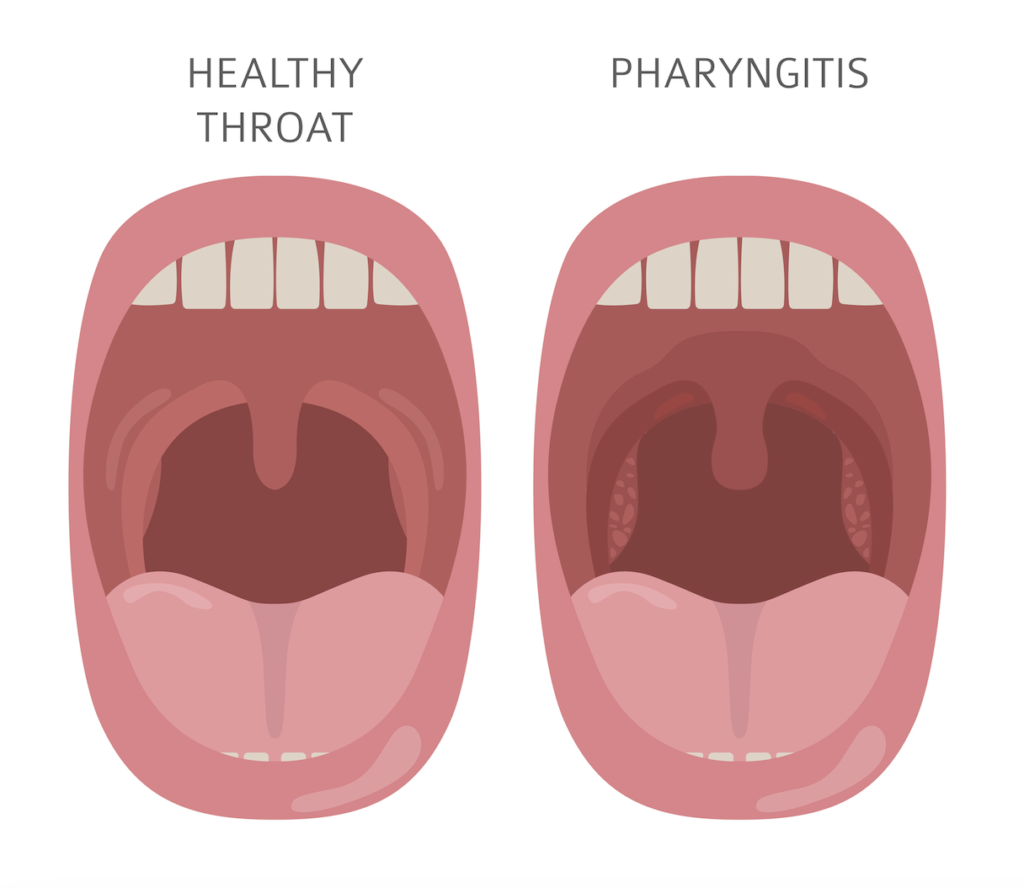 Deep Throat Vomiting guide tel